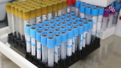 На Ставрополье 71% случаев приходятся на аденовирусы и 25% на ковид – минздрав