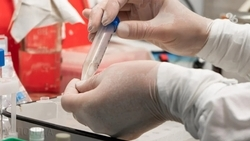 Биолабораторию для изучения инфекций планируют создать  в Грозном 