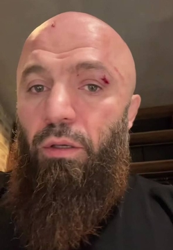 Махачкалинский боец ММА Магомед Исмаилов пострадал при взрыве пауэрбанка