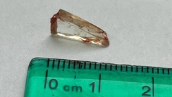 Хирурги достали осколок стекла из ноги ставропольчанки спустя 25 лет