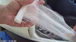 Автоинспекторы на Ставрополье помогли подростку, который порезал ногу