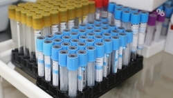 Новую методику лечения заболеваний крови применили в Астрахани 