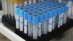 Погибших в Михайловске свиристелей проверят на птичий грипп