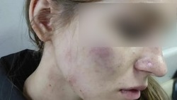 В Михайловске будут расследовать уголовное дело по факту нападения на девушку