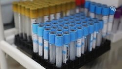 На Ставрополье тестами на прогрессирование ВИЧ обеспечены все пациенты
