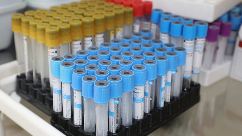 В Роспотребнадзоре по Ставрополью напомнили, что ВИЧ не передаётся воздушно-капельным путём